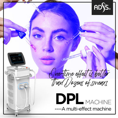 Máquina profissional do laser de DPL   Máquina do rejuvenescimento da pele do laser do IPL