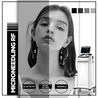 Máquina de Microneedling da radiofrequência, máquina de Thermolift para o salão de beleza dos termas